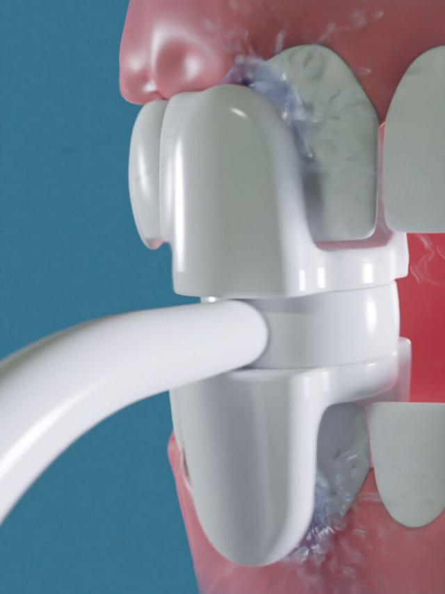 Produktbild von Munddusche Aufsätze "Miracle Smile" Zubehör, 2er-Set