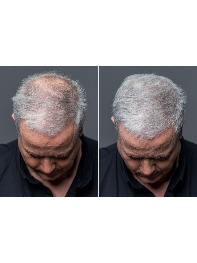 Produktbild von Streuhaar / Schütthaar zur Haarverdichtung "Volume Hair Fibres", 12 g