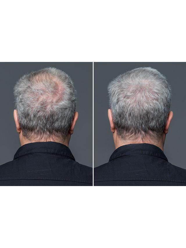 Produktbild von Streuhaar / Schütthaar zur Haarverdichtung "Volume Hair Fibres", 12 g