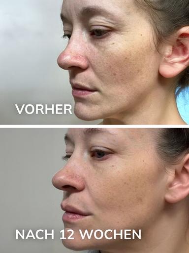 Produktbild 14 von 32